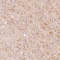 Anti-Glutamine Synthetase GLUL Rabbit Monoclonal Antibody